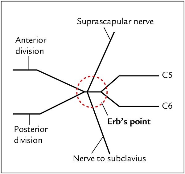 Erb's point, formation of the upper trunk
