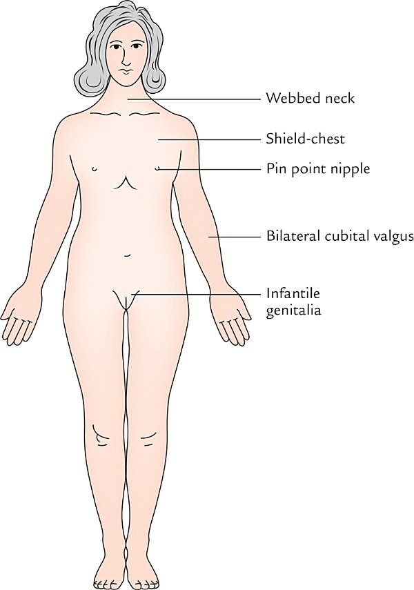 external phenotype, clinical photograph
